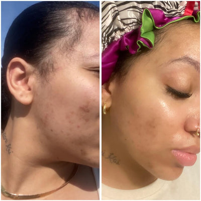 Cellufin™ Vibrating Face Brush Pro+