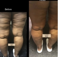 Ally L. review image 1